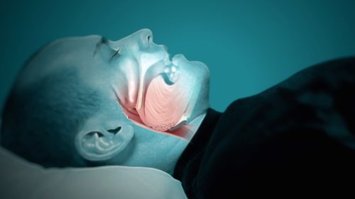 Ayurvedic Medicines For Sleep Apnea