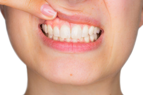 Ayurvedic Tips For Healthy Gums