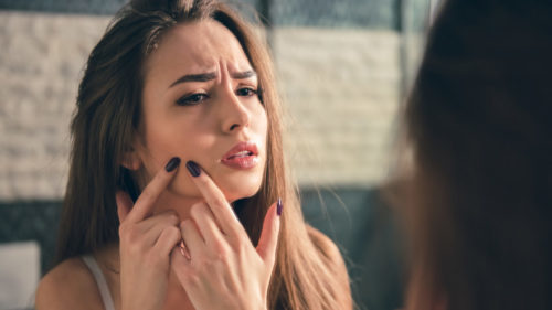 Ayurvedic Tips For Pimple Free Skin
