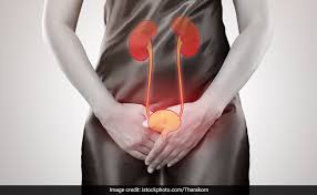 How To Ensure Urinary Health In Females