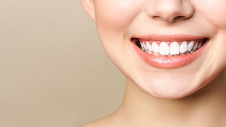 Natural Remedies For Bleeding Gums