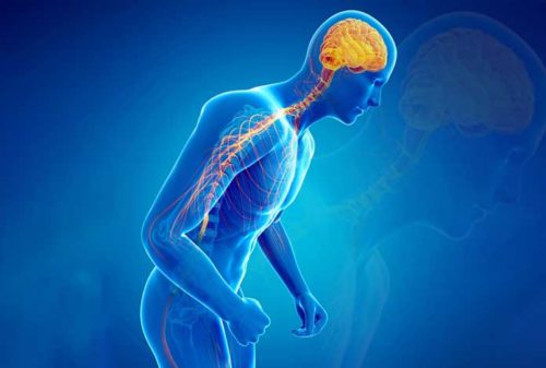 What Is Parkinson’s Disease
