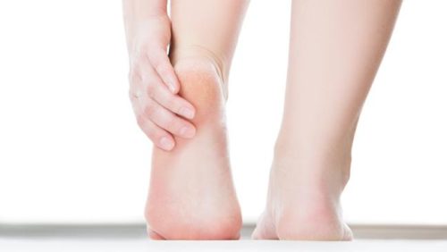 Natural Remedies For Cracked Heels