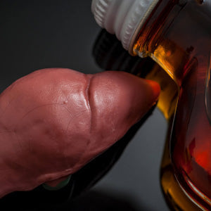 ALCHOLIC LIVER