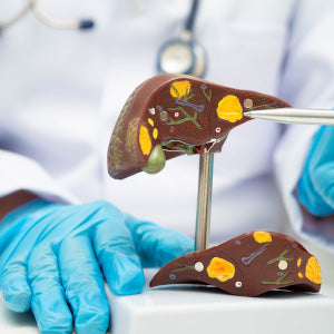 FATTY LIVER