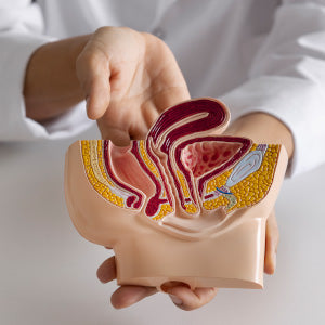 PEYRONIE DISEASE