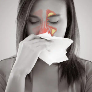 SINUSITIS