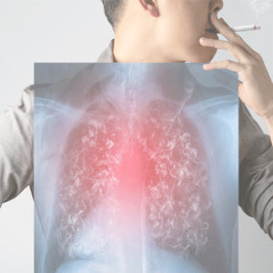 SMOKER’S LUNG CARE